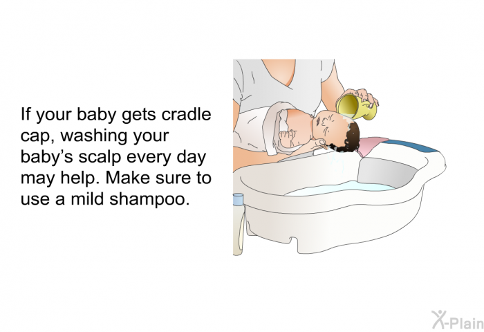 If your baby gets cradle cap, washing your baby's scalp every day may help. Make sure to use a mild shampoo.