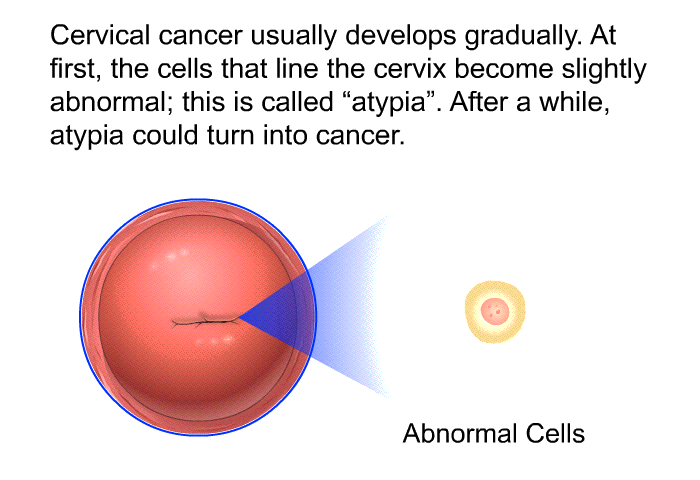 Cervical cancer usually develops gradually. At first, the cells that line the cervix become slightly abnormal; this is called “atypia”. After a while, atypia could turn into cancer.