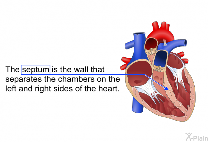 The septum is the wall that separates the chambers on the left and right sides of the heart.