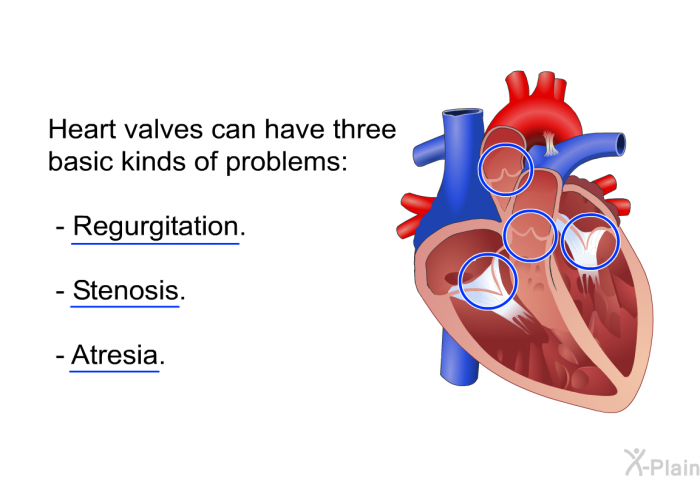 Heart valves can have three basic kinds of problems:  Regurgitation. Stenosis. Atresia.