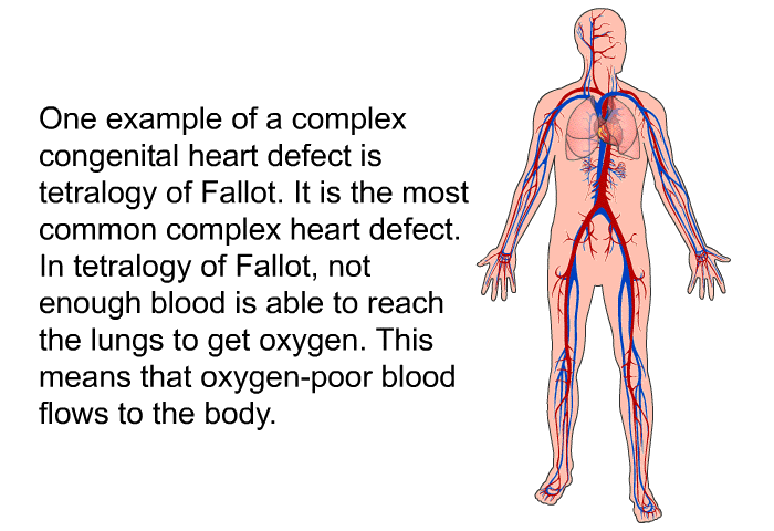 One example of a complex congenital heart defect is tetralogy of Fallot. It is the most common complex heart defect. In tetralogy of Fallot, not enough blood is able to reach the lungs to get oxygen. This means that oxygen-poor blood flows to the body.