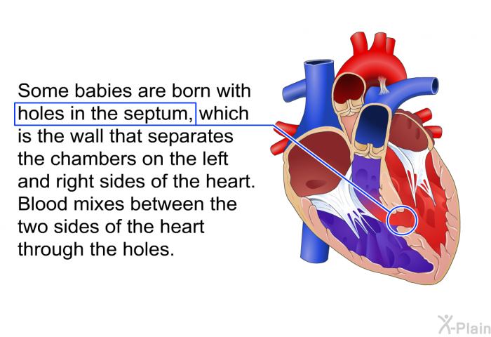 Some babies are born with holes in the septum, which is the wall that separates the chambers on the left and right sides of the heart. Blood mixes between the two sides of the heart through the holes.