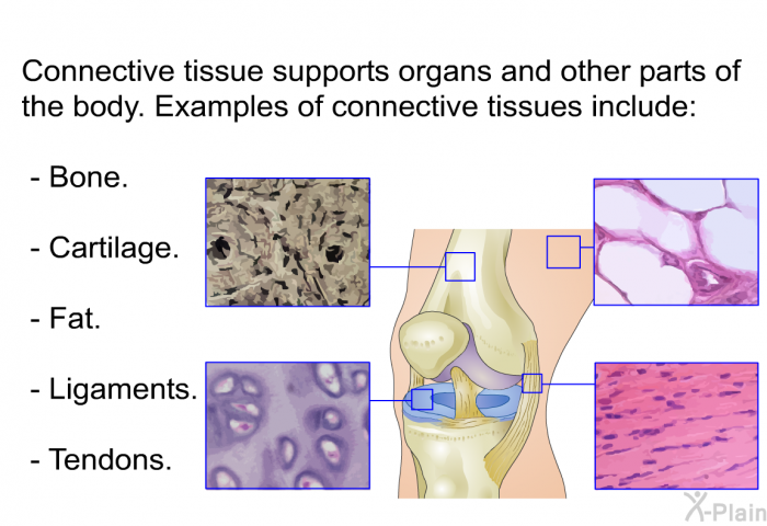 Connective tissue supports organs and other parts of the body. Examples of connective tissues include:  Bone. Cartilage. Fat. Ligaments. Tendons.