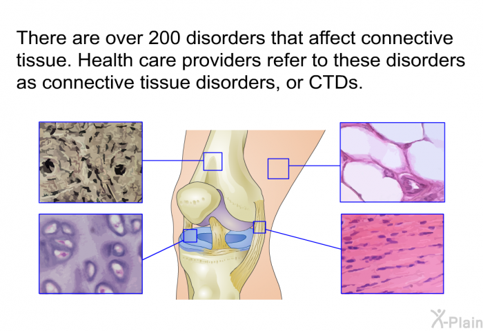 There are over 200 disorders that affect connective tissue. Health care providers refer to these disorders as connective tissue disorders, or CTDs.