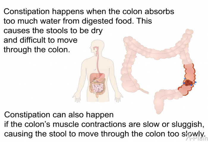 Constipation happens when the colon absorbs too much water from digested food. This causes the stools to be dry and difficult to move through the colon. Constipation can also happen if the colon's muscle contractions are slow or sluggish, causing the stool to move through the colon too slowly.