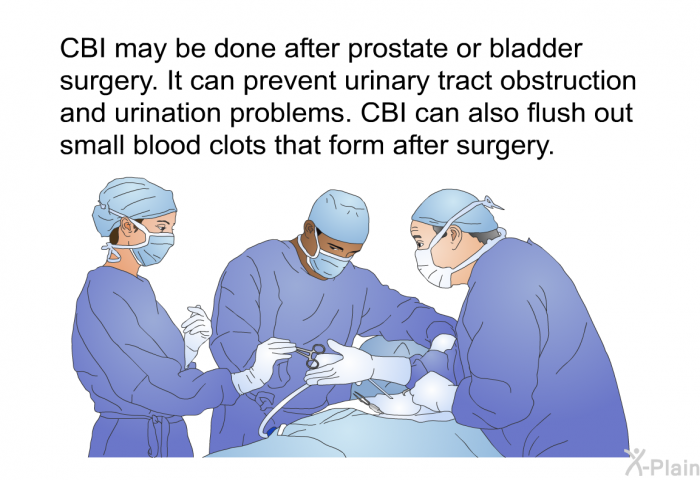 CBI may be done after prostate or bladder surgery. It can prevent urinary tract obstruction and urination problems. CBI can also flush out small blood clots that form after surgery.