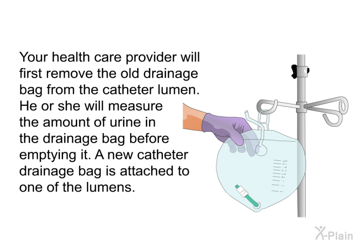 Your health care provider will first remove the old drainage bag from the catheter lumen. He or she will measure the amount of urine in the drainage bag before emptying it. A new catheter drainage bag is attached to one of the lumens.