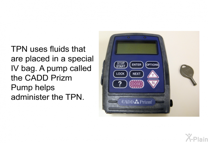 TPN uses fluids that are placed in a special IV bag. A pump called the CADD Prizm Pump helps administer the TPN.