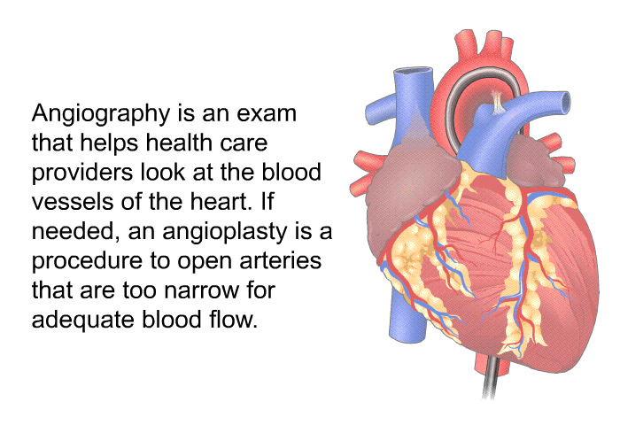 Angiography is an exam that helps health care providers look at the blood vessels of the heart. If needed, an angioplasty is a procedure to open arteries that are too narrow for adequate blood flow.