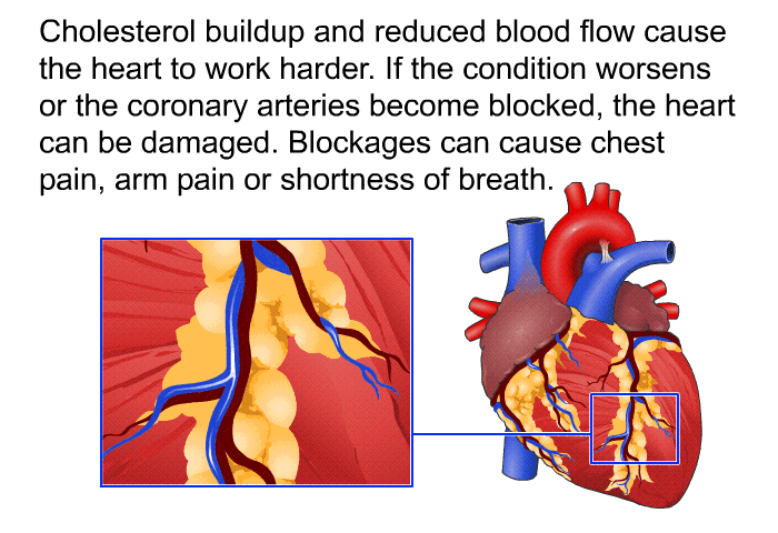 Cholesterol buildup and reduced blood flow cause the heart to work harder. If the condition worsens or the coronary arteries become blocked, the heart can be damaged. Blockages can cause chest pain, arm pain or shortness of breath.