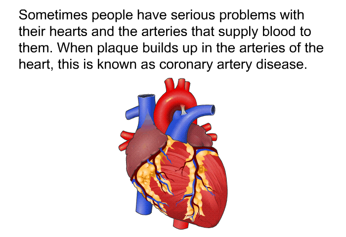 Sometimes people have serious problems with their hearts and the arteries that supply blood to them. When plaque builds up in the arteries of the heart, this is known as coronary artery disease.