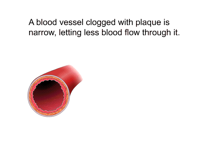 A blood vessel clogged with plaque is narrow, letting less blood flow through it.