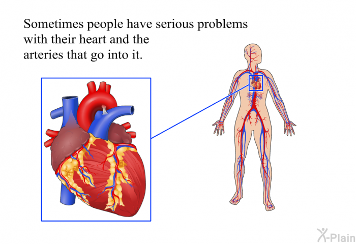 Sometimes people have serious problems with their heart and the arteries that go into it.