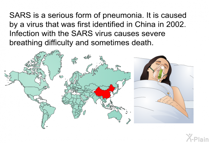 SARS is a serious form of pneumonia. It is caused by a virus that was first identified in China in 2002. Infection with the SARS virus causes severe breathing difficulty and sometimes death.