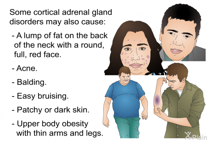 Some cortical adrenal gland disorders may also cause:  A lump of fat on the back of the neck with a round, full, red face. Acne. Balding. Easy bruising. Patchy or dark skin. Upper body obesity with thin arms and legs.