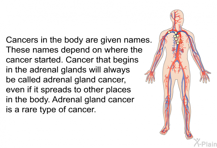 Cancers in the body are given names. These names depend on where the cancer started. Cancer that begins in the adrenal glands will always be called adrenal gland cancer, even if it spreads to other places in the body. Adrenal gland cancer is a rare type of cancer.