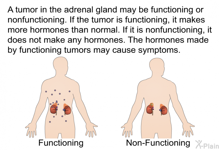 A tumor in the adrenal gland may be functioning or nonfunctioning. If the tumor is functioning, it makes more hormones than normal. If it is nonfunctioning, it does not make any hormones. The hormones made by functioning tumors may cause symptoms.