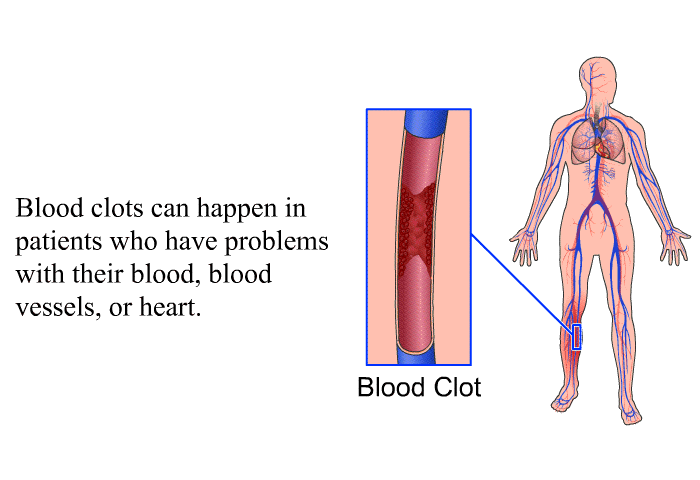 Blood clots can happen in patients who have problems with their blood, blood vessels, or heart.