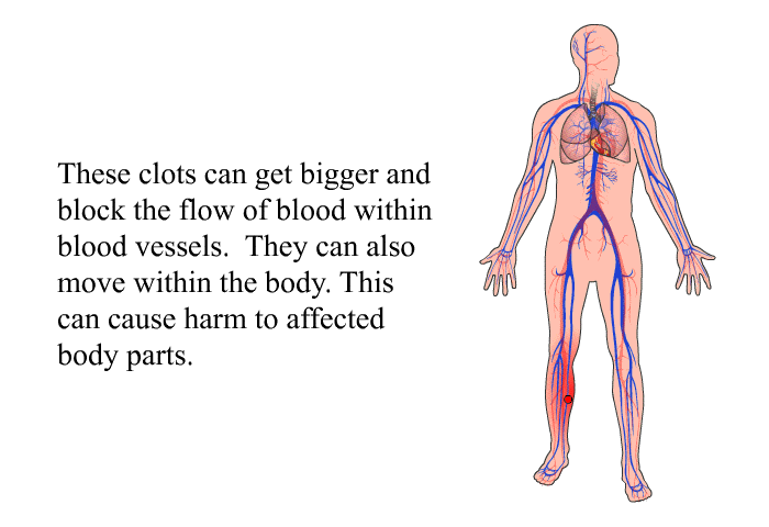 These clots can get bigger and block the flow of blood within blood vessels. They can also move within the body. This can cause harm to affected body parts.