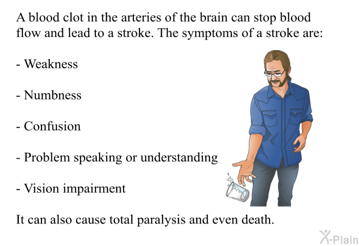 A blood clot in the arteries of the brain can stop blood flow and lead to a stroke. The symptoms of a stroke are:  Weakness Numbness Confusion Problem speaking or understanding Vision impairment

  It can also cause total paralysis and even death.