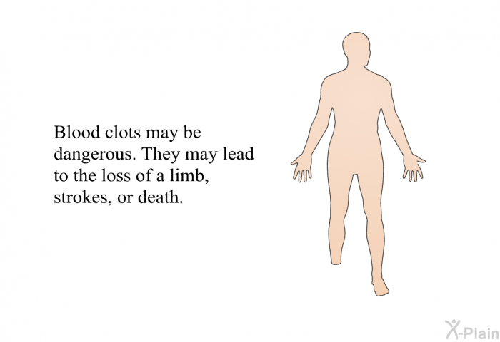 Blood clots may be dangerous. They may lead to the loss of a limb, strokes, or death.