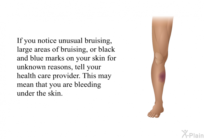 If you notice unusual bruising, large areas of bruising, or black and blue marks on your skin for unknown reasons, tell your health care provider. This may mean that you are bleeding under the skin.