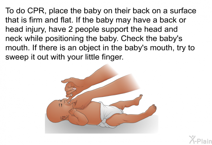 To do CPR, place the baby on their back on a surface that is firm and flat. If the baby may have a back or head injury, have 2 people support the head and neck while positioning the baby. Check the baby's mouth. If there is an object in the baby's mouth, try to sweep it out with your little finger.