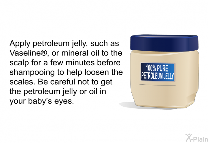 Apply petroleum jelly, such as Vaseline , or mineral oil to the scalp for a few minutes before shampooing to help loosen the scales. Be careful not to get the petroleum jelly or oil in your baby's eyes.