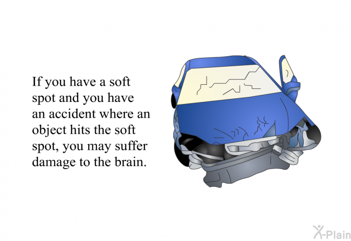 If you have a soft spot and you have an accident where an object hits the soft spot, you may suffer damage to the brain.