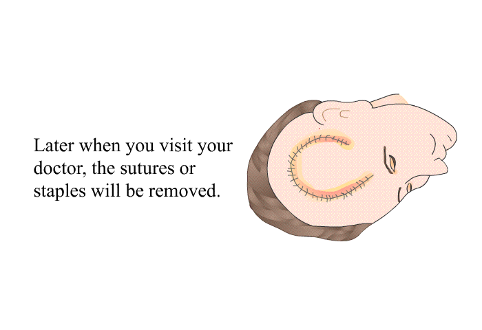 Later when you visit your doctor, the sutures or staples will be removed.