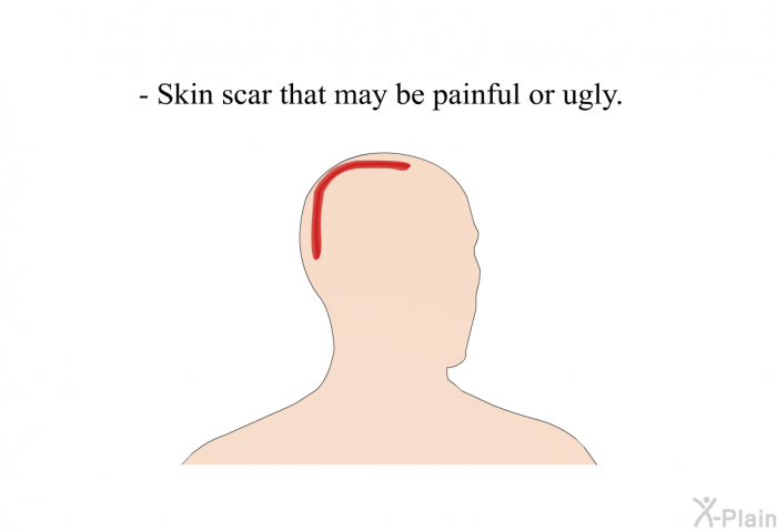 Skin scar that may be painful or ugly.