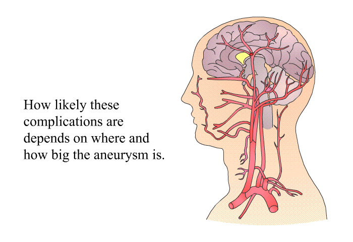 How likely these complications are depends on where and how big the aneurysm is.
