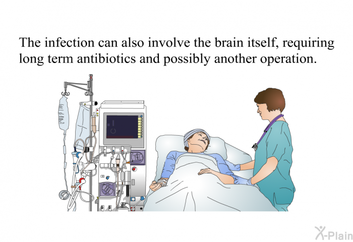 The infection can also involve the brain itself, requiring long term antibiotics and possibly another operation.