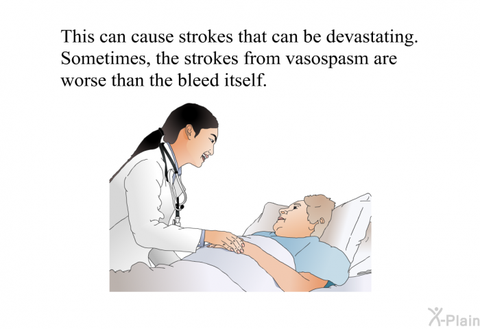 This can cause strokes that can be devastating. Sometimes, the strokes from vasospasm are worse than the bleed itself.