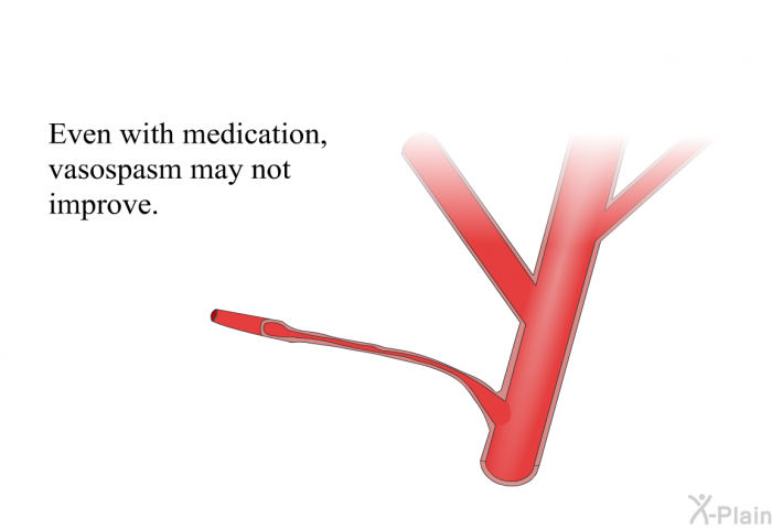 Even with medication, vasospasm may not improve.