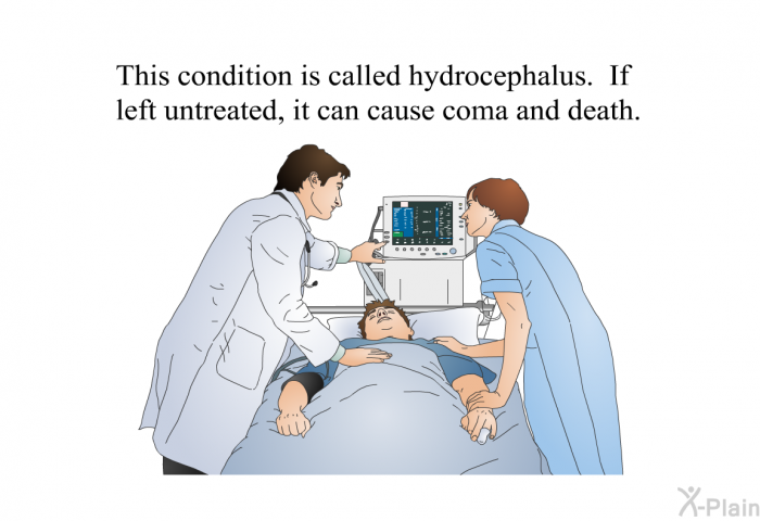 This condition is called hydrocephalus. If left untreated, it can cause coma and death.