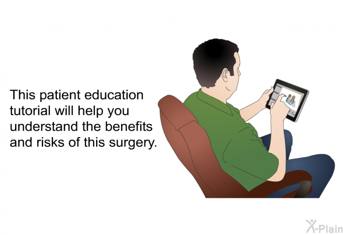 This health information will help you understand the benefits and risks of this surgery.