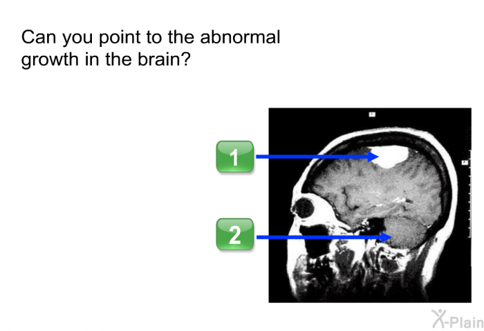 Can you point to the abnormal growth in the brain?