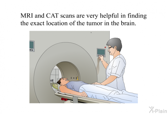 MRI and CAT scans are very helpful in finding the exact location of the tumor in the brain.
