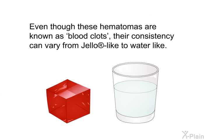 Even though these hematomas are known as  blood clots', their consistency can vary from Jello -like to water like.