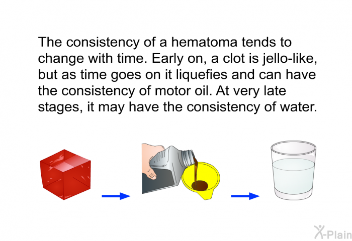 The consistency of a hematoma tends to change with time. Early on, a clot is jello-like, but as time goes on it liquefies and can have the consistency of motor oil. At very late stages, it may have the consistency of water.