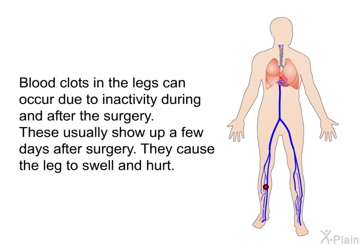 Blood clots in the legs can occur due to inactivity during and after the surgery. These usually show up a few days after surgery. They cause the leg to swell and hurt.