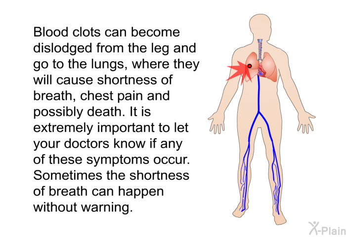Blood clots can become dislodged from the leg and go to the lungs, where they will cause shortness of breath, chest pain and possibly death. It is extremely important to let your doctors know if any of these symptoms occur. Sometimes the shortness of breath can happen without warning.