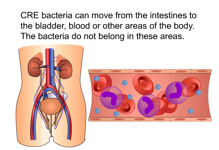 CRE bacteria can move from the intestines to the bladder, blood or other areas of the body. The bacteria do not belong in these areas.