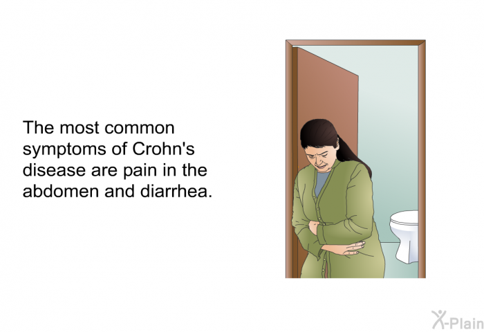 The most common symptoms of Crohn's disease are pain in the abdomen and diarrhea.