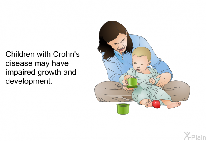 Children with Crohn's disease may have impaired growth and development.
