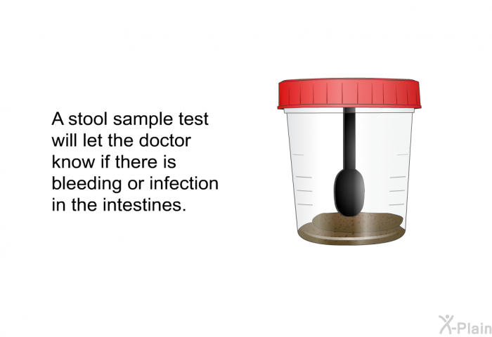 A stool sample test will let the doctor know if there is bleeding or infection in the intestines.
