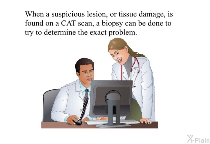 When a suspicious lesion, or tissue damage, is found on a CAT scan, a biopsy can be done to try to determine the exact problem.