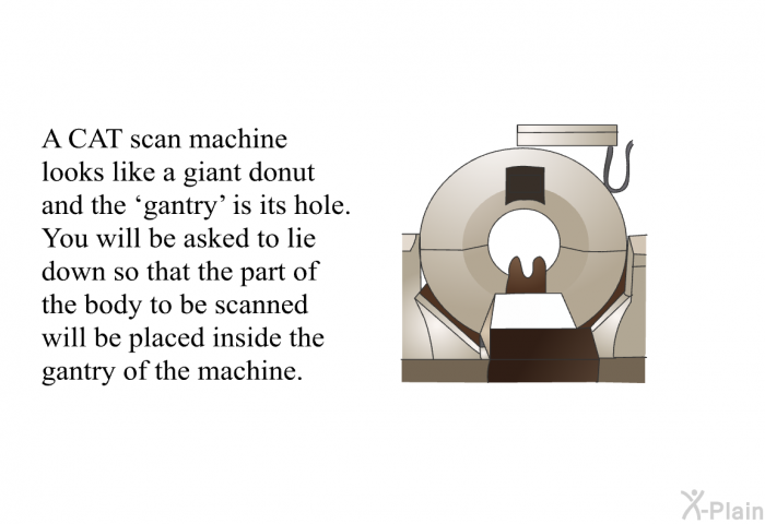 A CAT scan machine looks like a giant donut and the  gantry' is its hole. You will be asked to lie down so that the part of the body to be scanned will be placed inside the gantry of the machine.