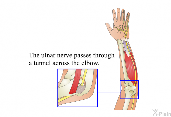 The ulnar nerve passes through a tunnel across the elbow.